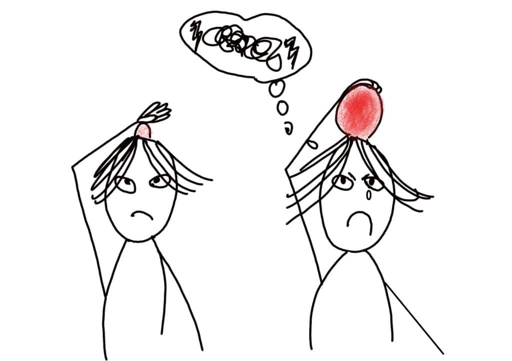 decodage douleur